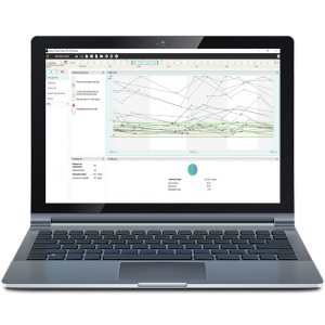 Accu-Chek Smart Pix Accu-Chek Smart Pix